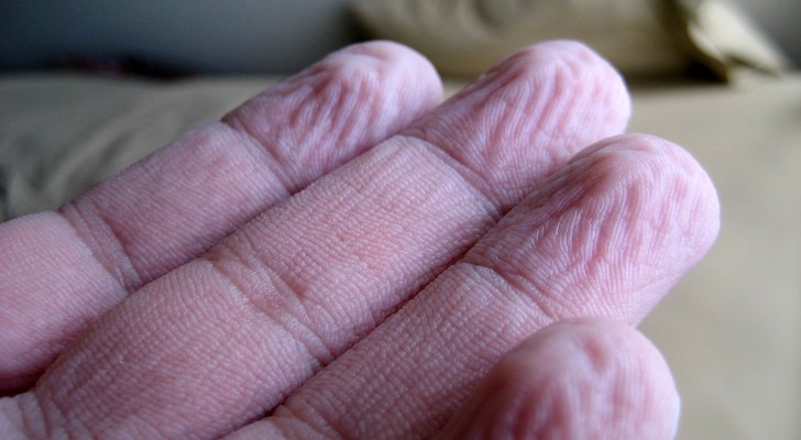 Waarom rimpelt de huid van handen en voeten na lange tijd in het water te hebben gelegen? De wetenschap heeft het antwoord gevonden