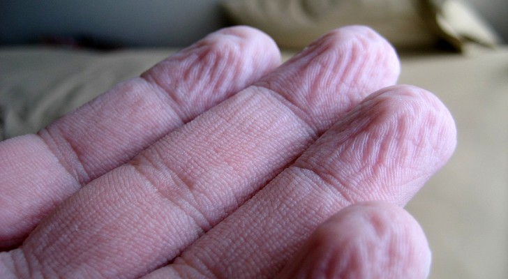 Perché la pelle degli arti si raggrinzisce stando a lungo in acqua? La scienza ha trovato la risposta