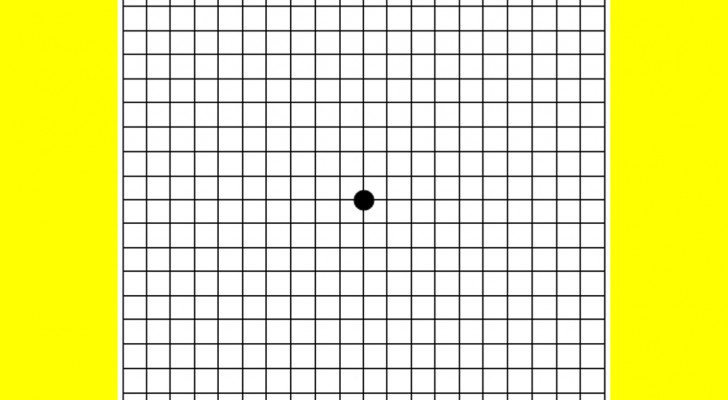 Copri un occhio e fissa il punto nero al centro: il test usato dai medici per scoprire questo problema agli occhi