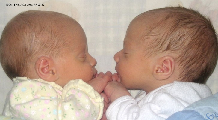 Gêmeos nascem de pais diferentes: veja o que aconteceu