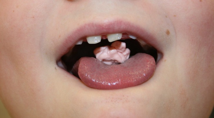 Ecco cosa succede se ingeriamo accidentalmente un chewing gum: falsi miti e verità