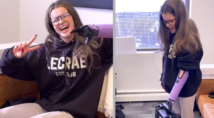En 15-årig tjej får tillbaka sitt leende, hennes nya protes får henne att känna sig som en superhjälte (VIDEO)