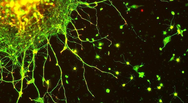 Neuronen kunnen op afstand draadloos communiceren, suggereert een nieuwe studie