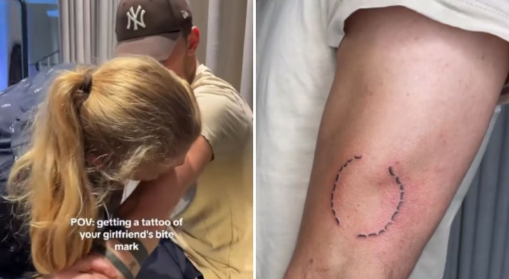Il se fait tatouer la morsure de sa petite amie sur le bras : un "geste d'amour" qui divise le web
