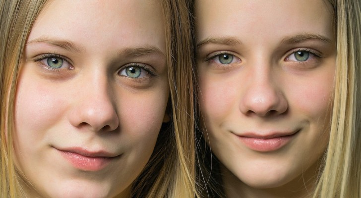 Är enäggstvillingar verkligen identiska? Så här skiljer de sig åt