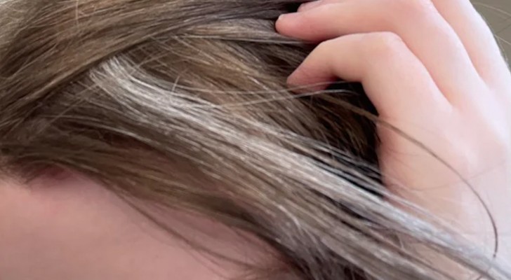 Ora sappiamo se lo stress può davvero causare i capelli bianchi