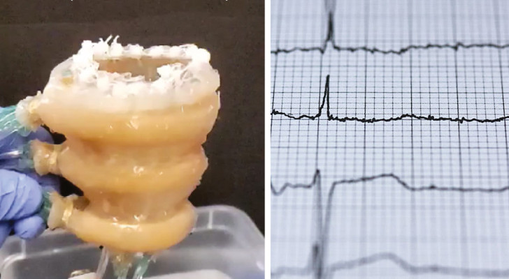 Forskare har skapat ett robothjärta: det slår som ett riktigt hjärta