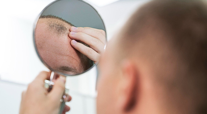Voici pourquoi de nombreux hommes perdent leurs cheveux et deviennent chauves, beaucoup plus que les femmes
