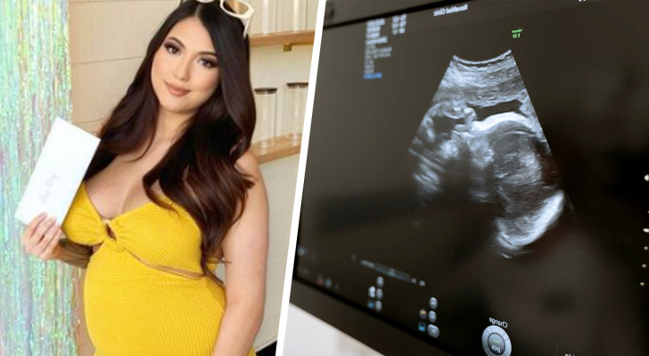 "Meine Nichte wusste ganz genau, dass ich schwanger war, noch bevor ich den Schwangerschaftstest gemacht habe."