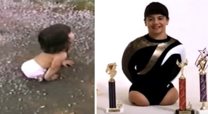 No obstante la discapacidad logra a convertirse en una gimnasta: 16 años despues hace un descubrimiento increible